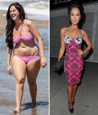 photos avant et après la perte de poids